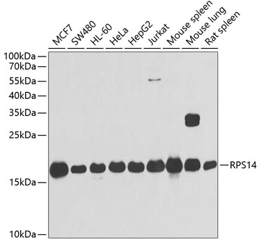 RPS14 Polyclonal Antibody (E-AB-61327)