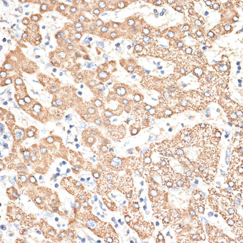 KIR3DS1 Polyclonal Antibody (E-AB-62805)