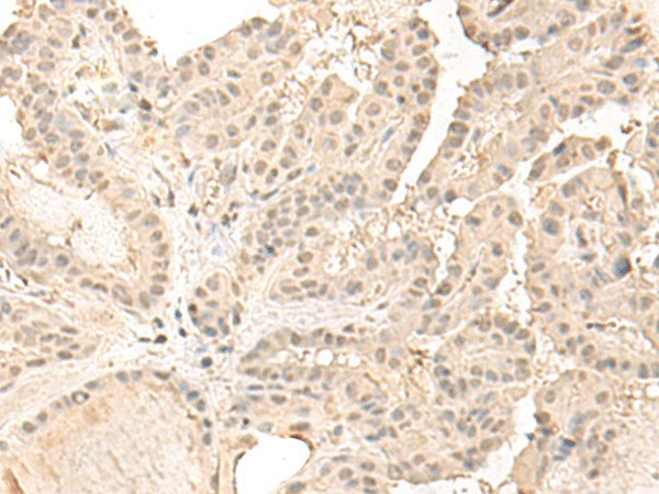ZGPAT Polyclonal Antibody (E-AB-52650)