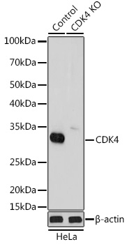 (KO Validated) CDK4 Polyclonal Antibody (E-AB-93172)