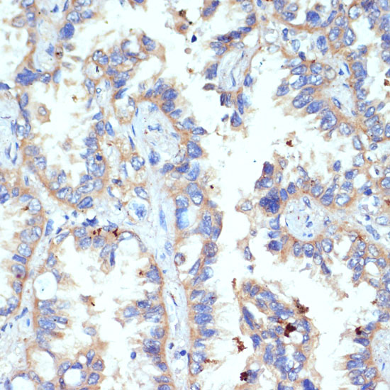 CD47 Polyclonal Antibody (E-AB-67354)