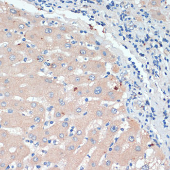 DBH Polyclonal Antibody (E-AB-66182)