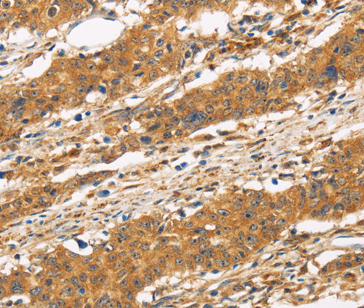CD22 Polyclonal Antibody (E-AB-11050)