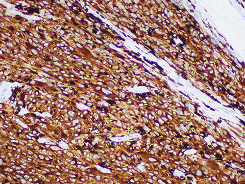 MART-1/melan A Monoclonal Antibody (ELAB6702-M)