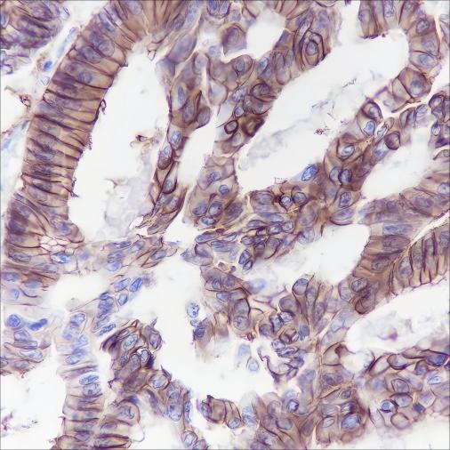 Recombinant Cadherin-17 Monoclonal Antibody (AN301416L)