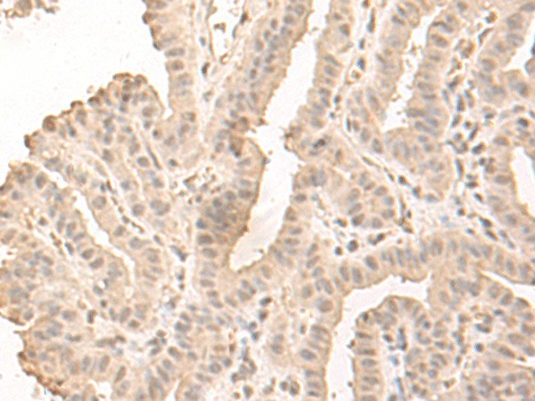 SAP130 Polyclonal Antibody (E-AB-18746)