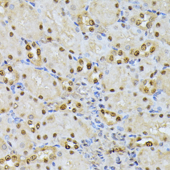 RPS27A Polyclonal Antibody (E-AB-66315)