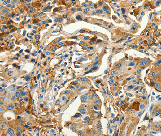CALCA Polyclonal Antibody (E-AB-16210)