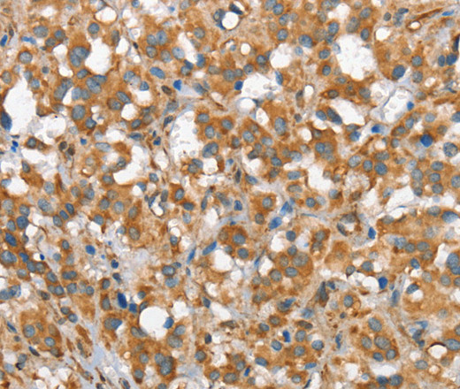 CSMD1 Polyclonal Antibody (E-AB-13174)
