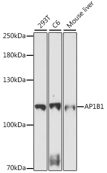 AP1B1 Polyclonal Antibody (E-AB-91496)