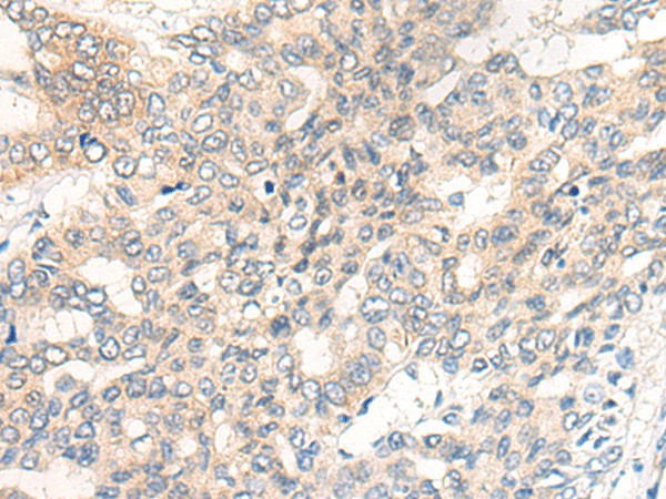 CHRD Polyclonal Antibody (E-AB-18617)