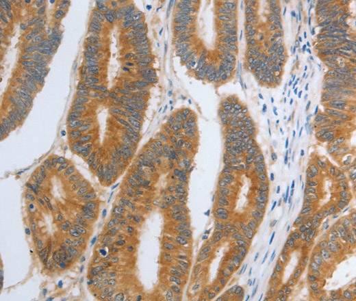RHEB Polyclonal Antibody (E-AB-12263)