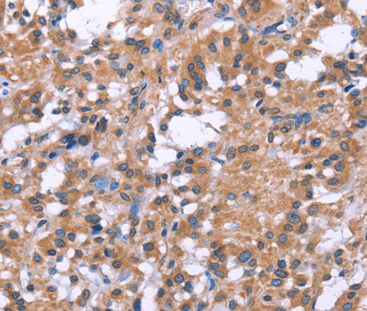 GPR172B Polyclonal Antibody (E-AB-13279)
