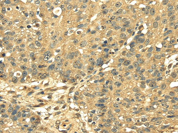 RPS3 Polyclonal Antibody (E-AB-17008)