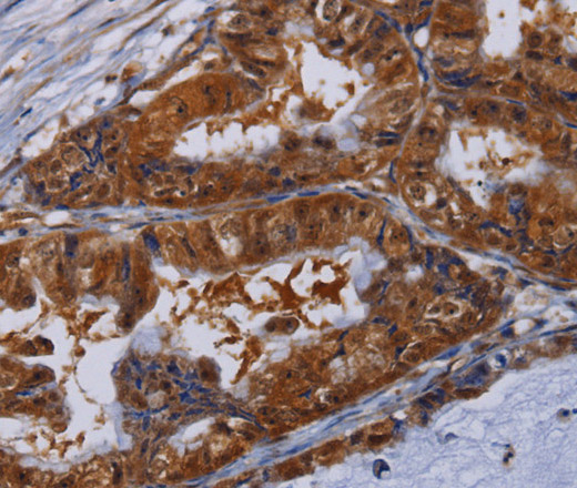 MFAP3L Polyclonal Antibody (E-AB-15201)