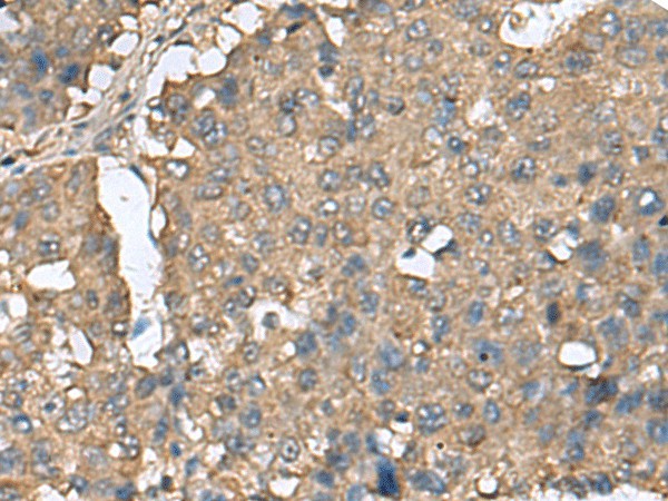 EIF4A2 Polyclonal Antibody (E-AB-19148)