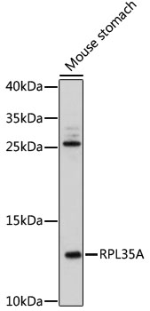 RPL35A Polyclonal Antibody (E-AB-91958)