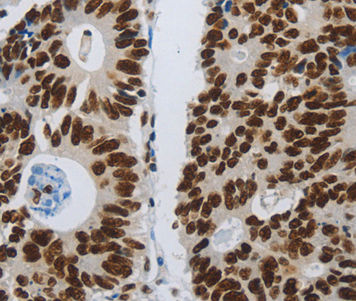 SLC16A14 Polyclonal Antibody (E-AB-12559)