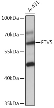 ETV5 Polyclonal Antibody (E-AB-91955)