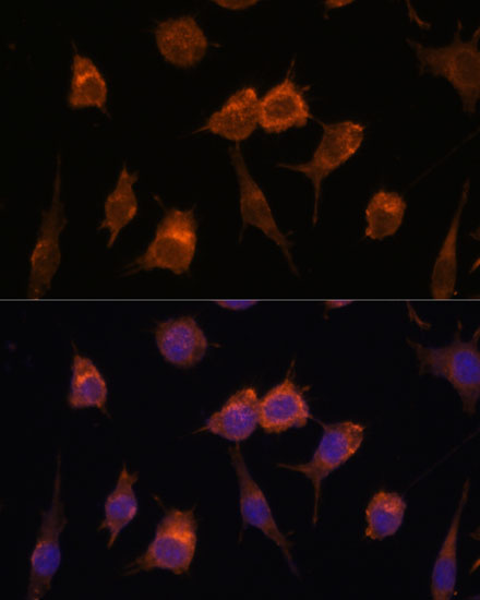 AVIL Polyclonal Antibody (E-AB-66574)