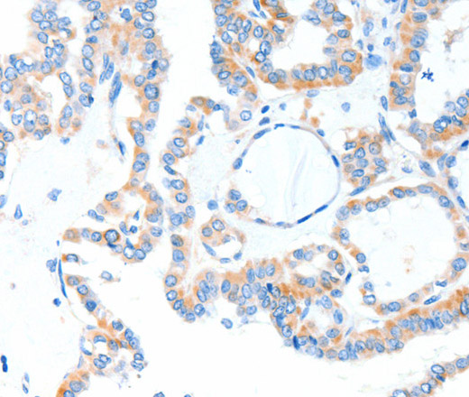 TLR2 Polyclonal Antibody (E-AB-13835)