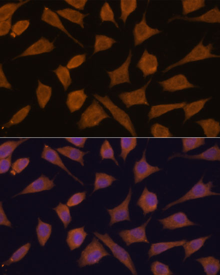 SEPT3 Polyclonal Antibody (E-AB-66849)