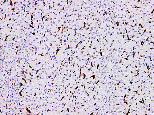 CD163 Monoclonal Antibody (ELAB6146-M)