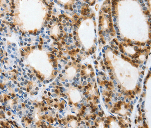 SELENOS Polyclonal Antibody (E-AB-15863)
