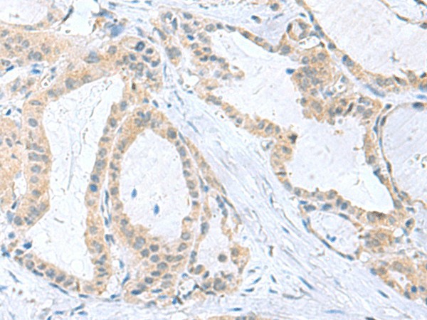 PDE6D Polyclonal Antibody (E-AB-19128)