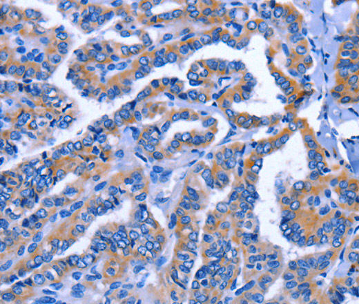 IGSF10 Polyclonal Antibody (E-AB-14151)
