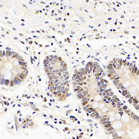 Mineralocorticoid receptor Polyclonal Antibody (E-AB-70261)