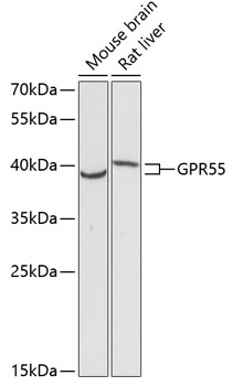 GPR55 Polyclonal Antibody (E-AB-65977)
