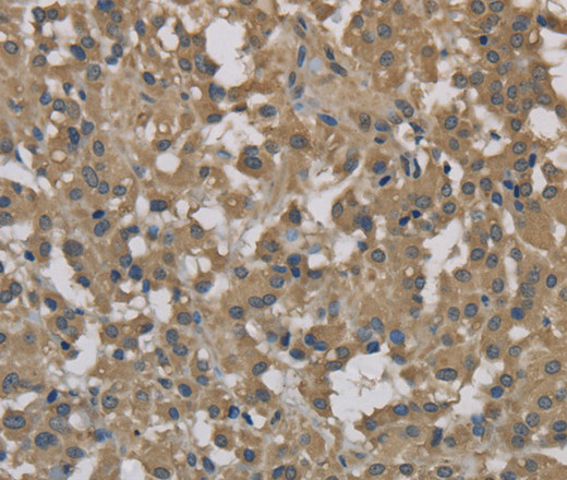 DCTN3 Polyclonal Antibody (E-AB-11144)