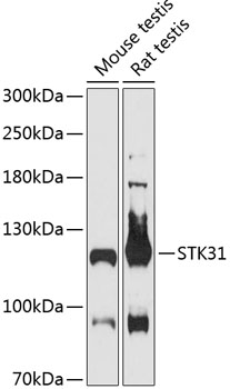 STK31 Polyclonal Antibody (E-AB-90577)