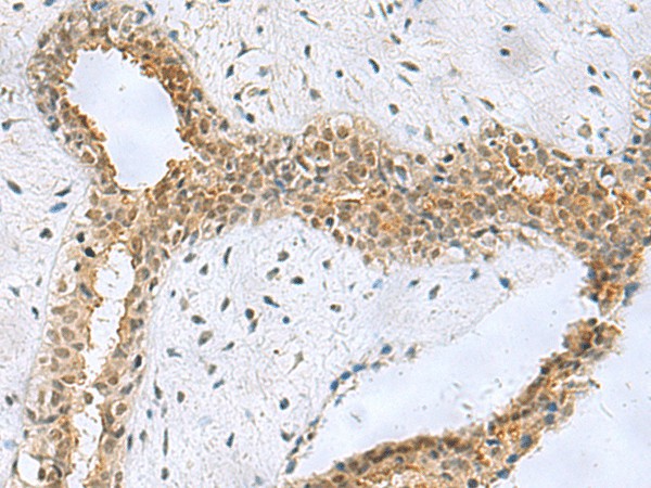 NABP1 Polyclonal Antibody (E-AB-53082)