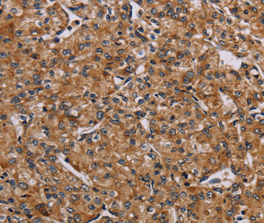 AATK Polyclonal Antibody (E-AB-16642)