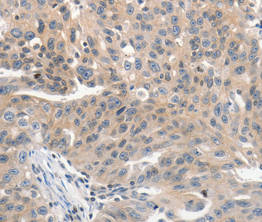 PRKD1 Polyclonal Antibody (E-AB-16035)