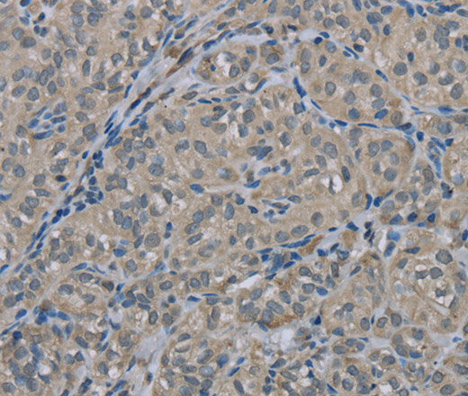 EDN1 Polyclonal Antibody (E-AB-14997)