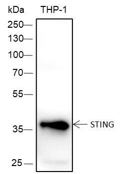 Recombinant STING Monoclonal Antibody (AN301666L)