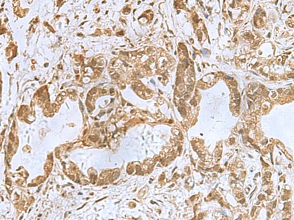 PHF6 Polyclonal Antibody (E-AB-52168)