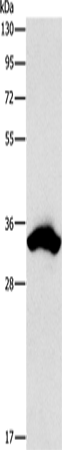 CDCA8 Polyclonal Antibody (E-AB-10868)