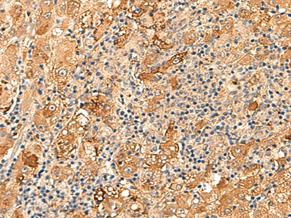 KCNE3 Polyclonal Antibody (E-AB-52872)