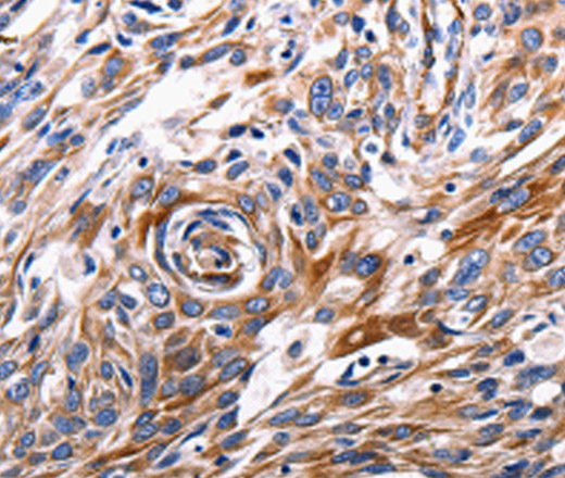 ACE2 Polyclonal Antibody (E-AB-12224)