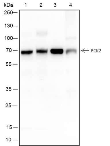 Recombinant PCK2 Monoclonal Antibody (AN301621L)