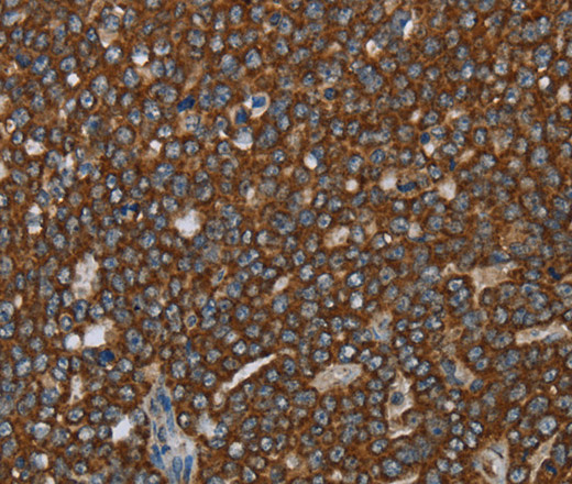GCKR Polyclonal Antibody (E-AB-15063)
