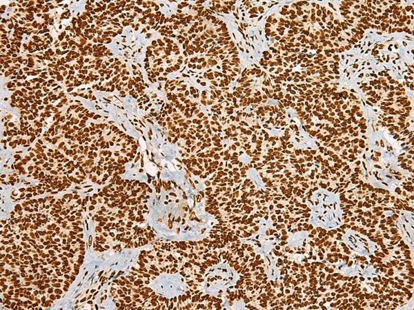 HABP4 Polyclonal Antibody (E-AB-19974)