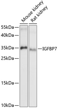 IGFBP7 Polyclonal Antibody (E-AB-90553)