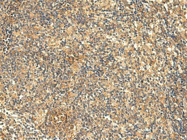 KIAA0513 Polyclonal Antibody (E-AB-18964)