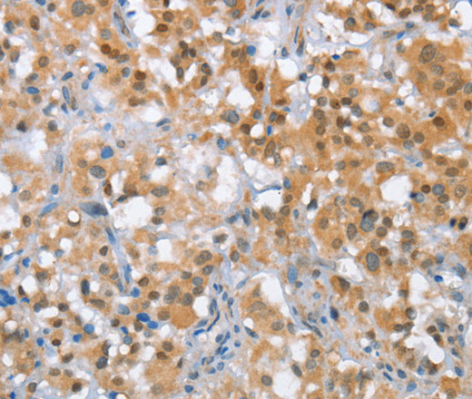 MLH1 Polyclonal Antibody (E-AB-10471)