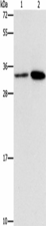 CDC34 Polyclonal Antibody (E-AB-16330)